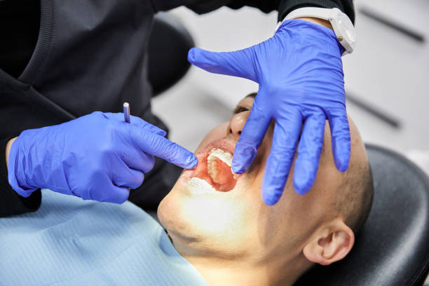 Best Emergency Tooth Extraction in Fuller Heights, FL